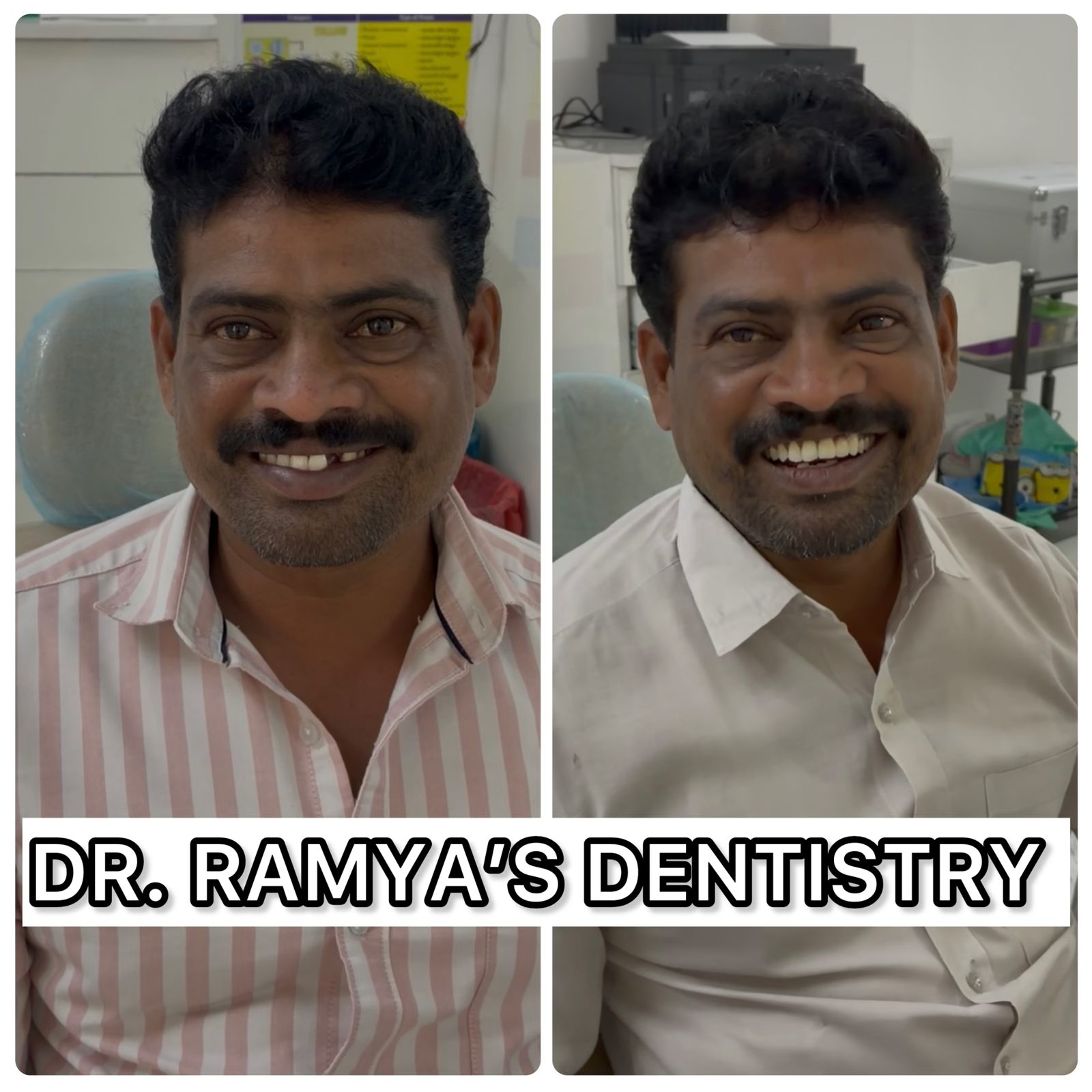 Implant Transformation